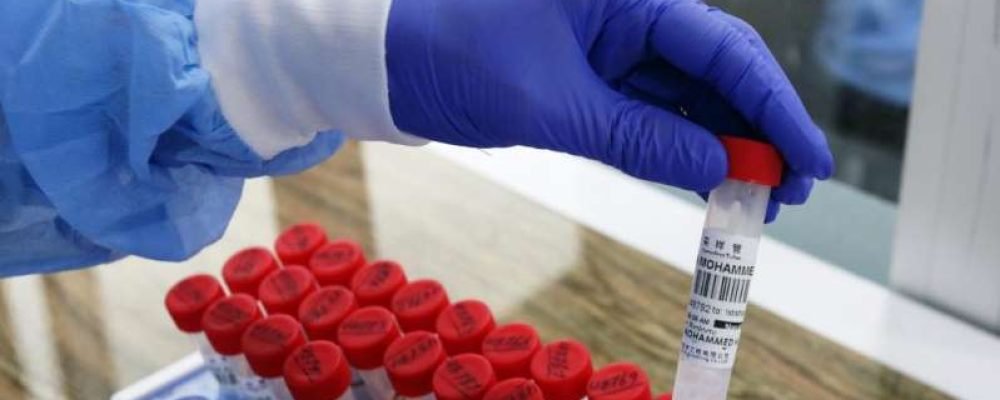 Антитела с короткой жизнью