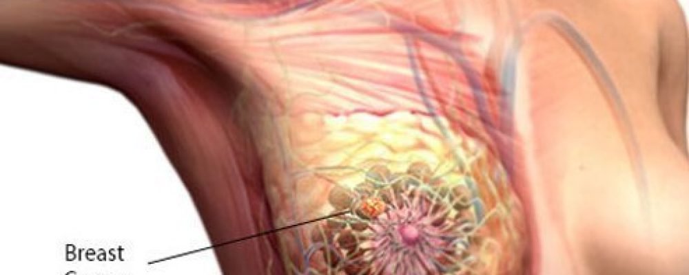 Банк надежды