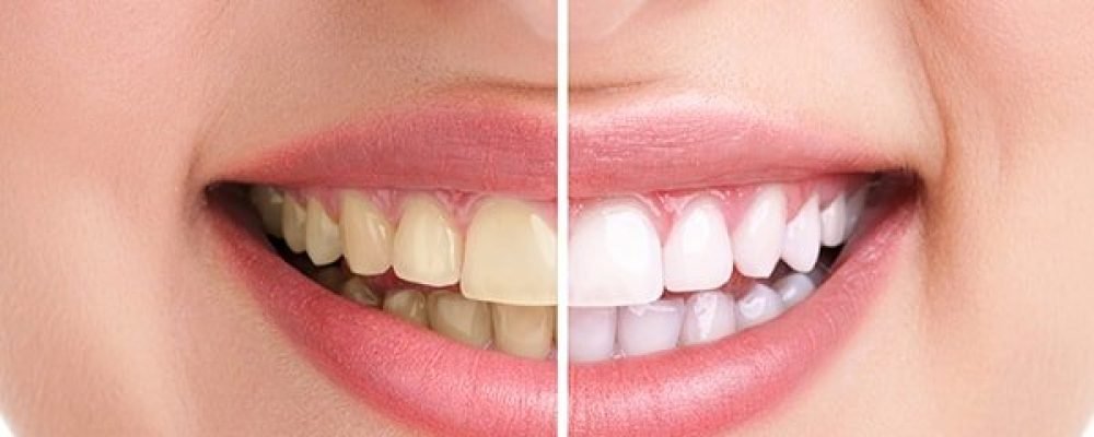 Улыбайтесь!